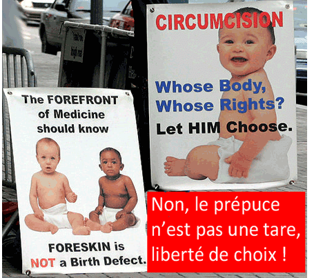 La circoncision, crime contre l’humanité…